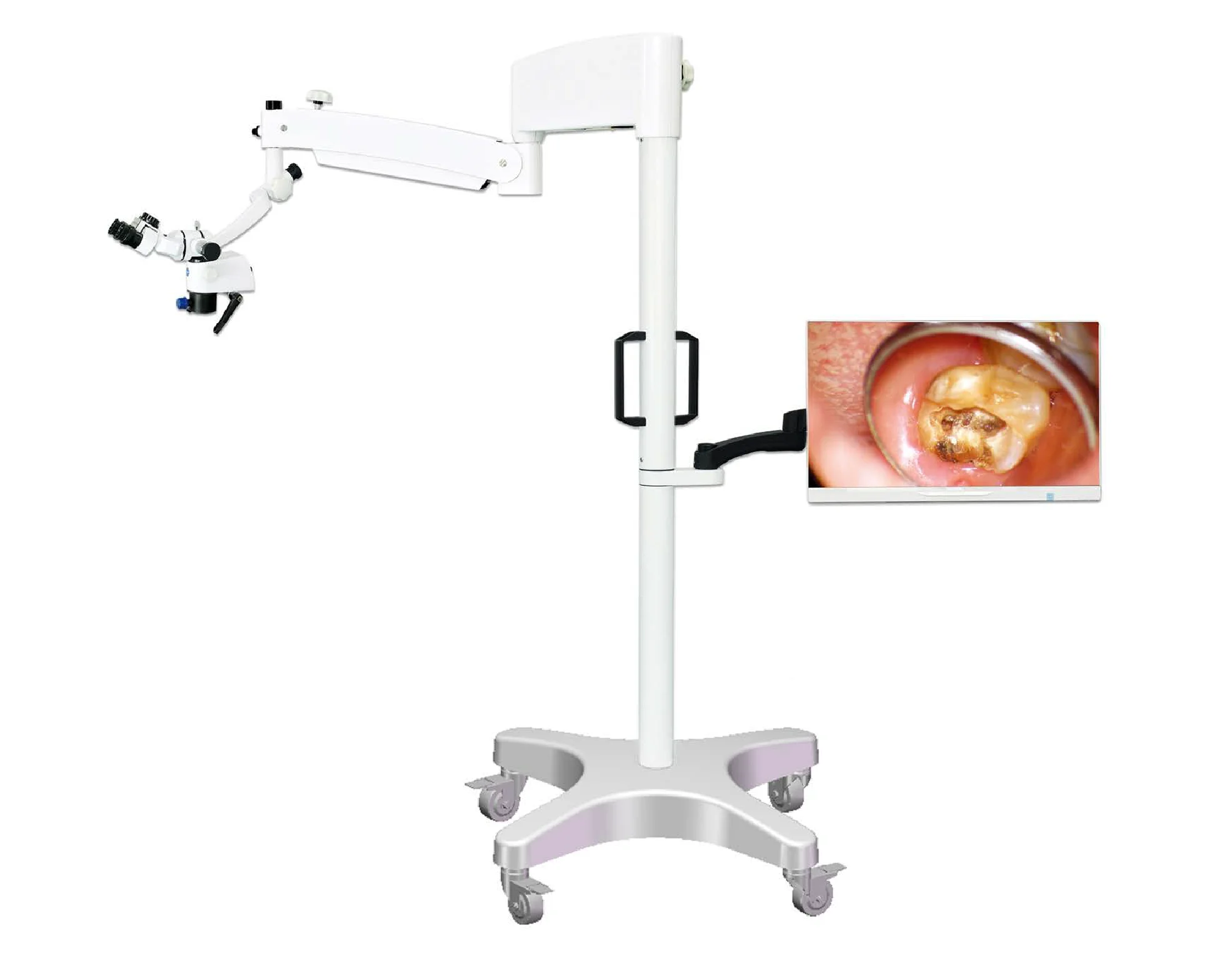Operating Dental Surgical Microscope