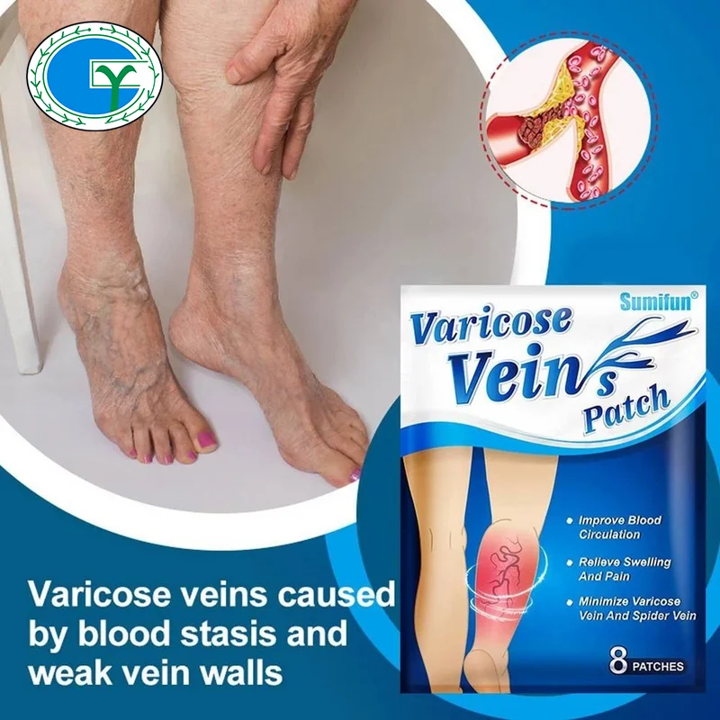 Sumifun 8pcs/bag Chinese Varicose Veins Plaster Vasculitis Phlebitis Spider Leg Medical Patch Angiitis Removal Patch