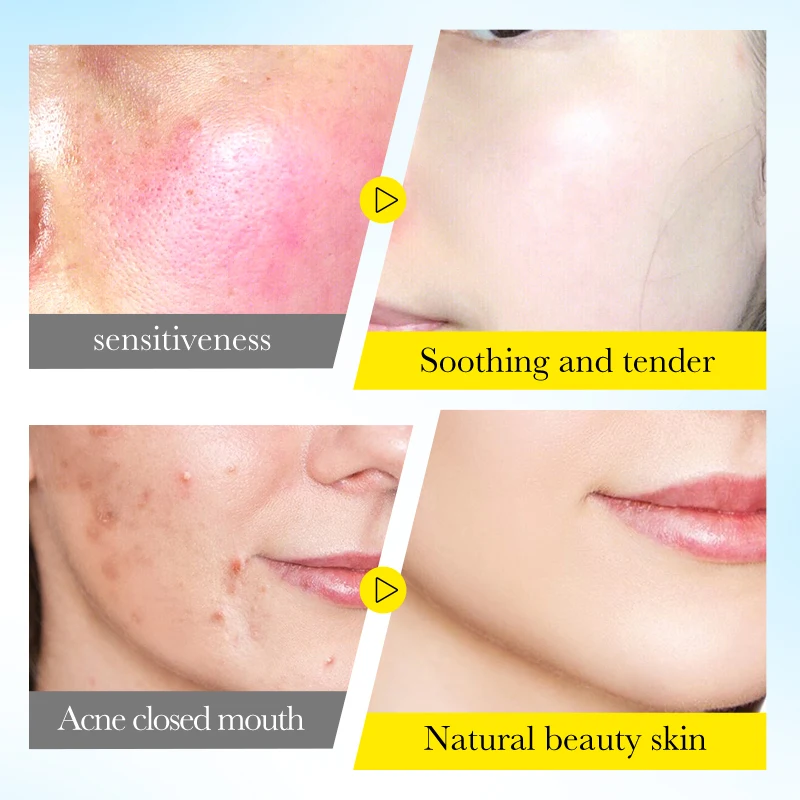 OEM ODM Wholesale SADOER Chamomile Petals Soothing Anti Allergy Crystal Jelly Soft Mask Deep Moisturizing Tender Face Skin