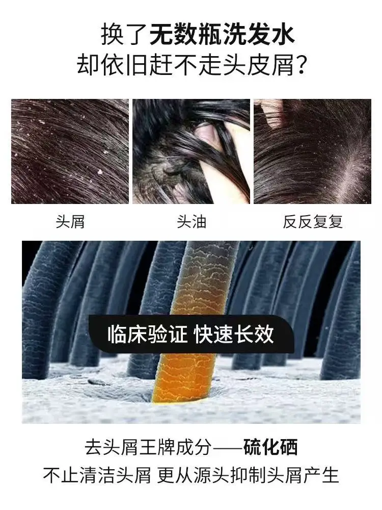 Hot Selling Quality Selsuun Strong Dandruff Control Oil Anti-Itch Moisturizing Soothing Anti-Hair Loss Refreshing Shampoo