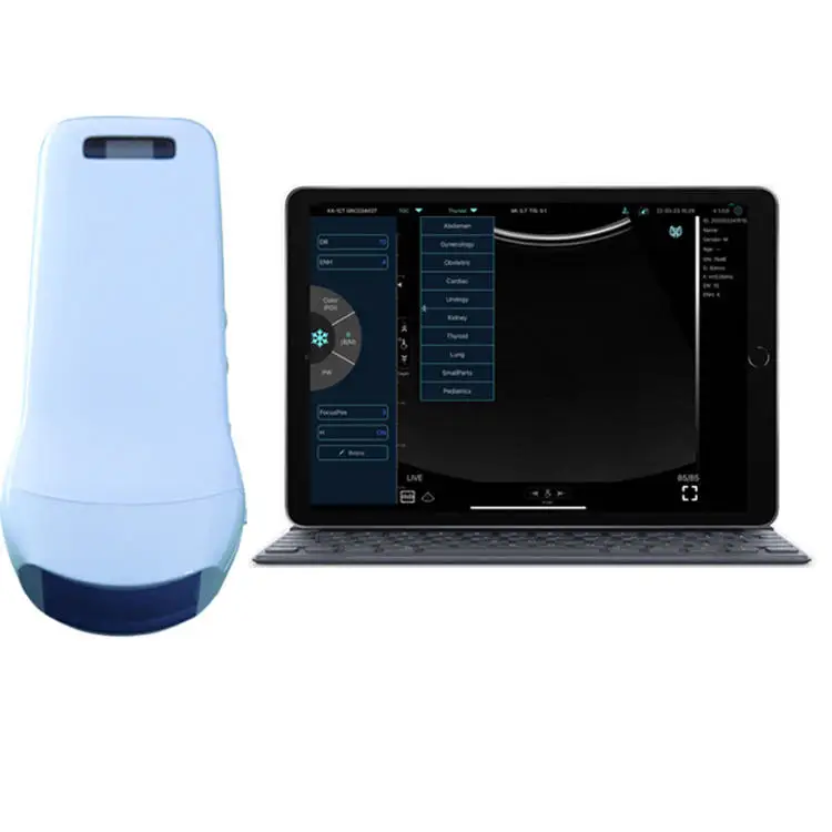 portable analogue &digital 2d /3d/4d machine medical ultrasound