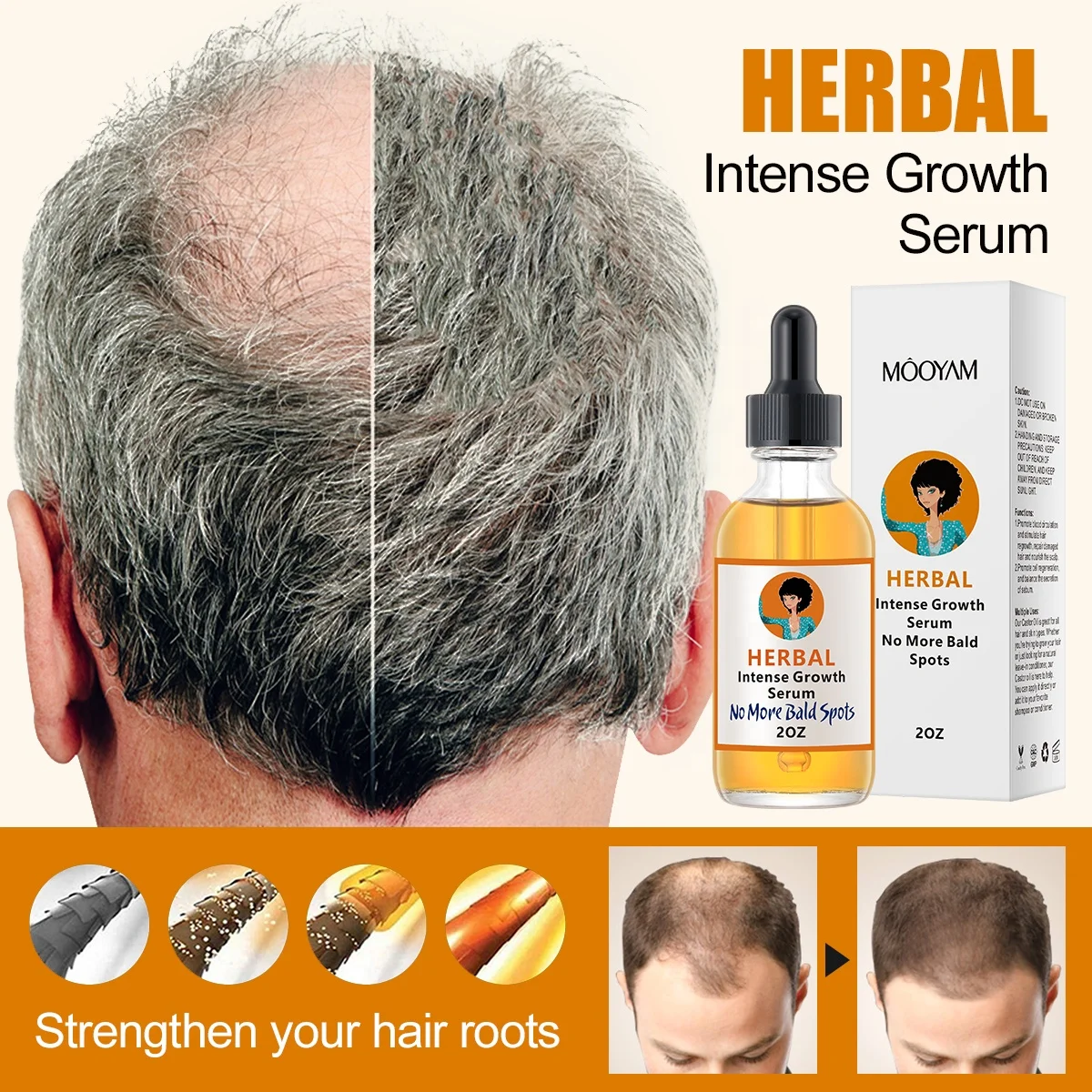 Private Label Anti Loss Serum Hair Growth Oil Alopecia Hair Loss Treatment Products Organic Herbal Regrowth Oil