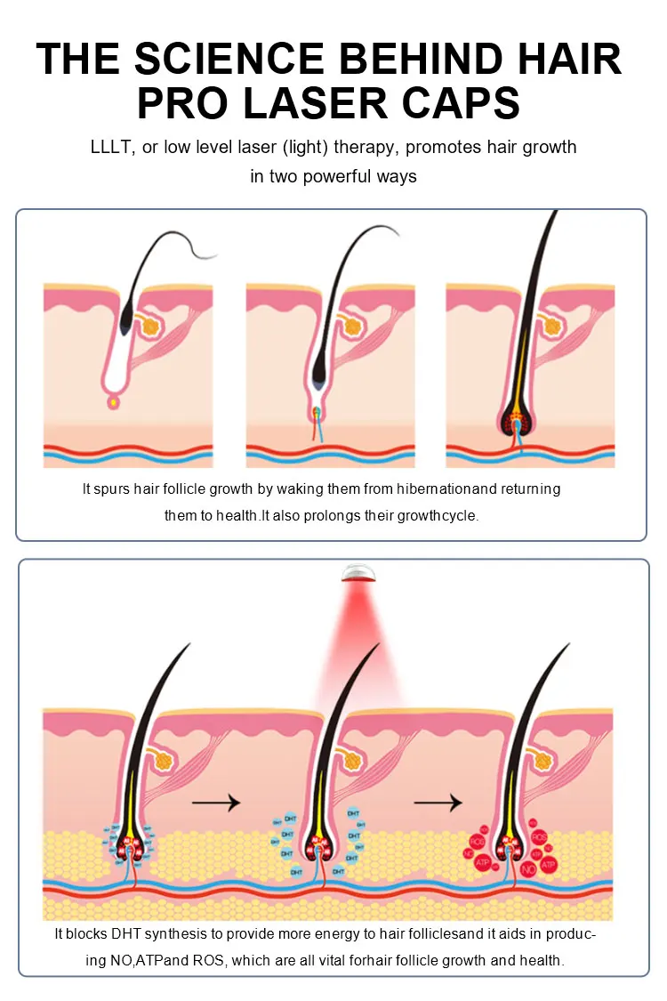 haircare 200pcs Medical Lasers diodes  Hair loss 510k medical  IR infrared red  therapy  help hair growth helmet at home