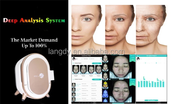  УФ-анализ кожи M9 Wood lamp для эстетиков сухой жирной