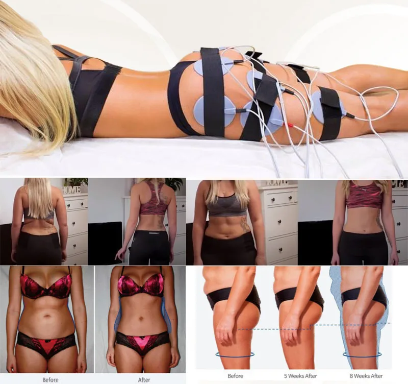 Au-6804 Auro EMS Micro-Current Muscle Toning Cellulite Reduction Slimming Machine