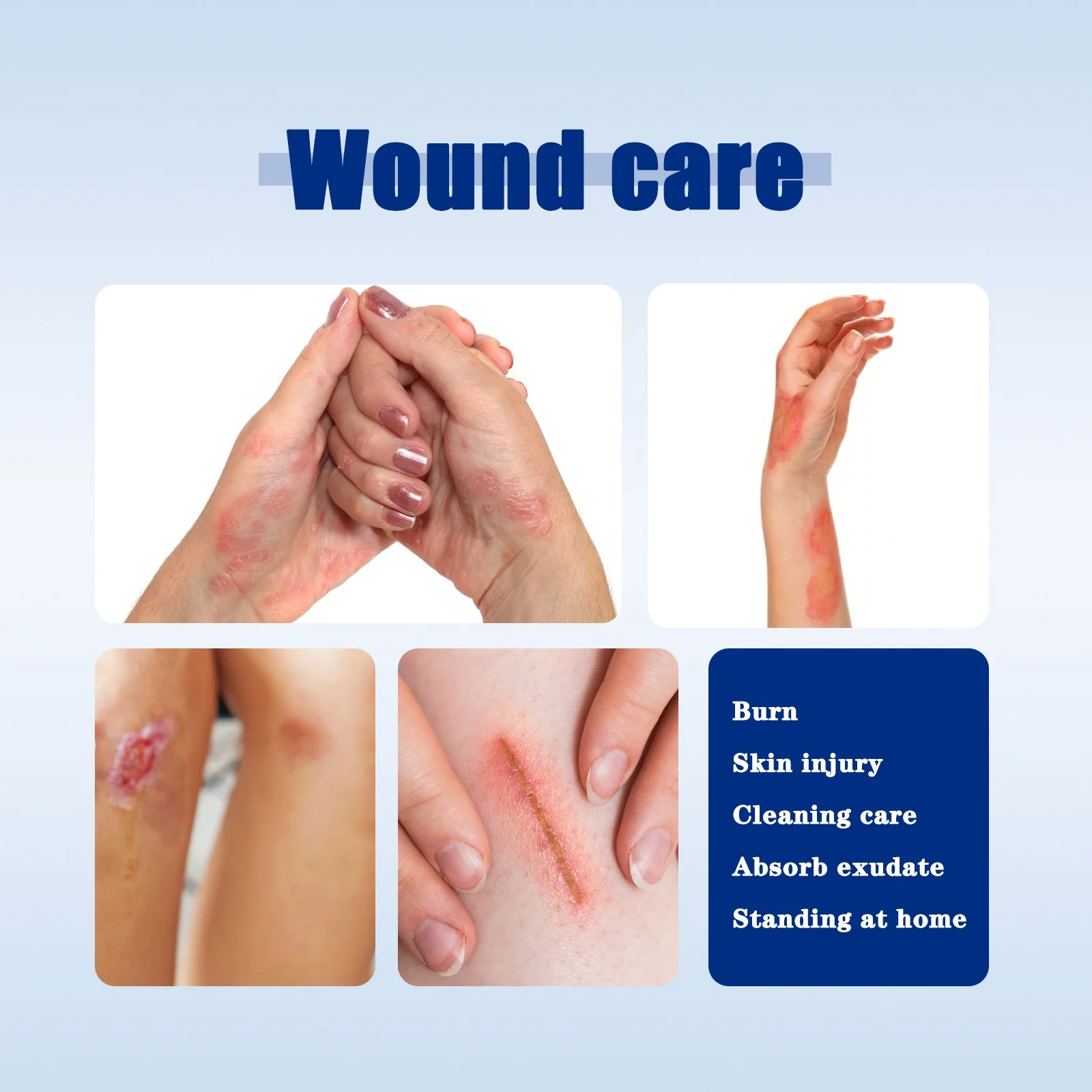 Wholesale Medical Burn and Scald Accessories Gauze Hemostasis Bandage Clean Wound Dustproof and Breathable