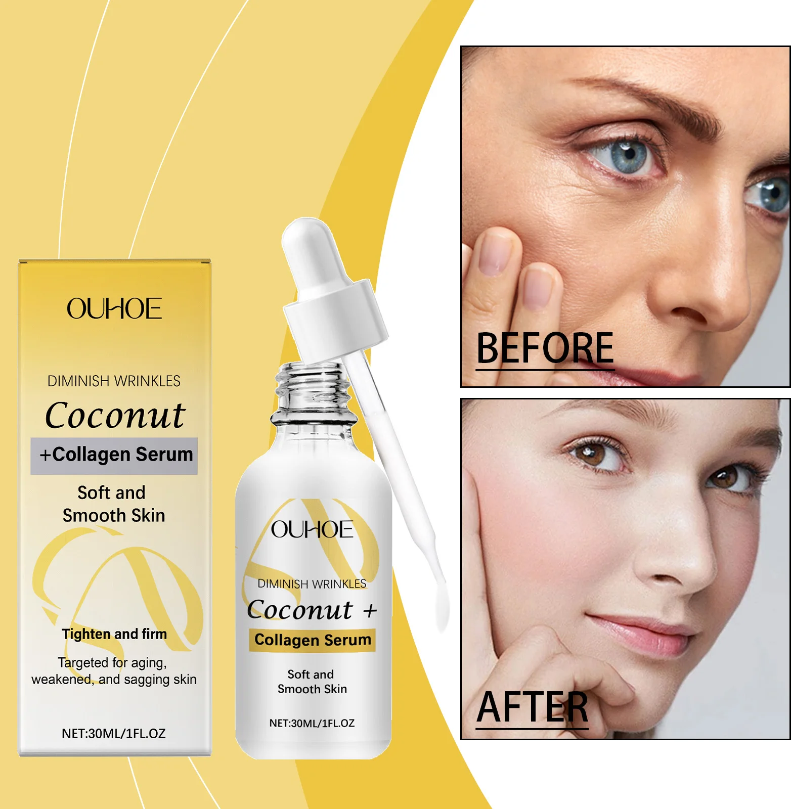 Luxury Manufacturers Ship Hyaluronic Acid Facial Essence Milk To Brighten The Skin, Moisturize And Anti-Wrinkle Facial Serum