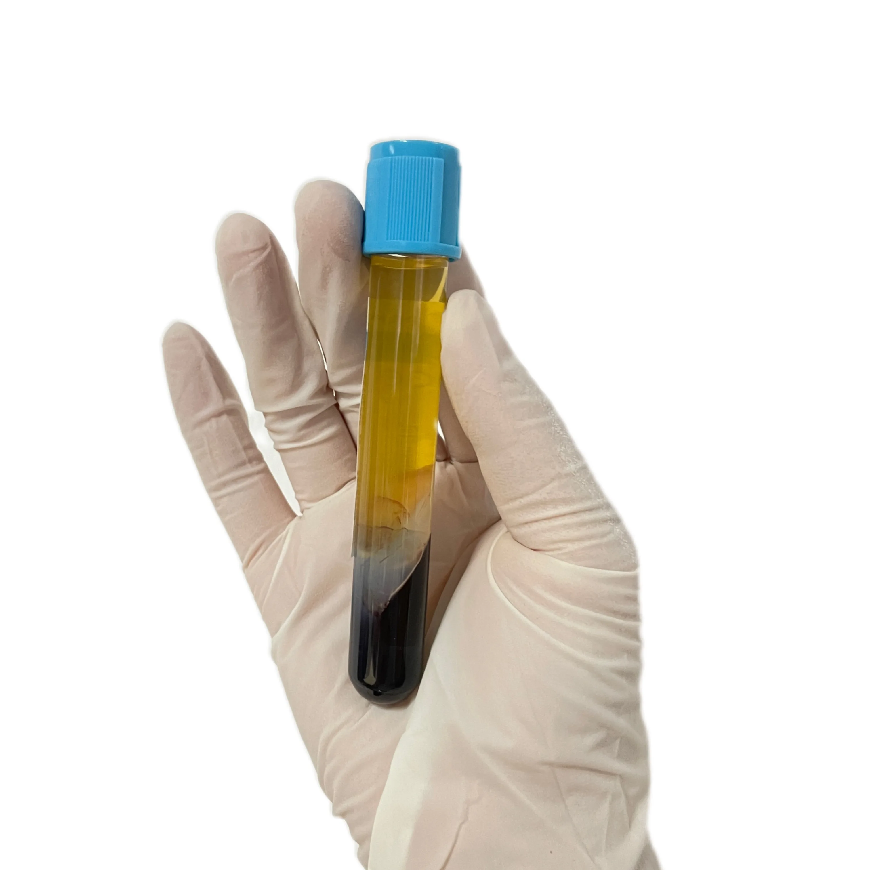 Hot sales PRP PRF  8ml 10ml 12ml 15ml Platelet rich plasma/Sodium citrate/Biotin with gel tube