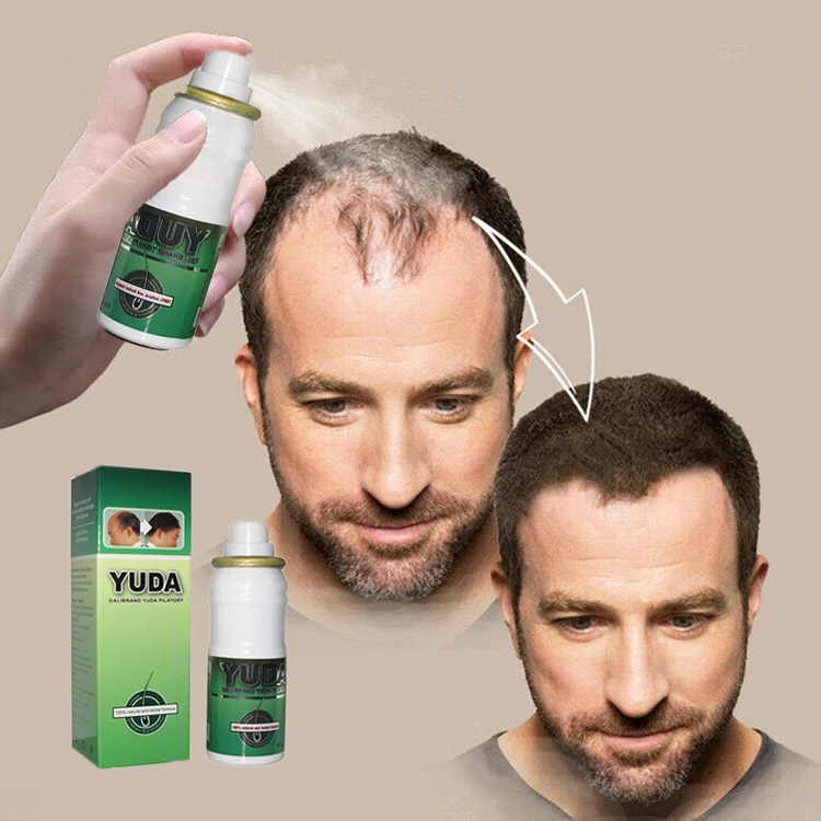 Hair Growth Products Yuda Fast Hair Regrowth Hair Loss Serum
