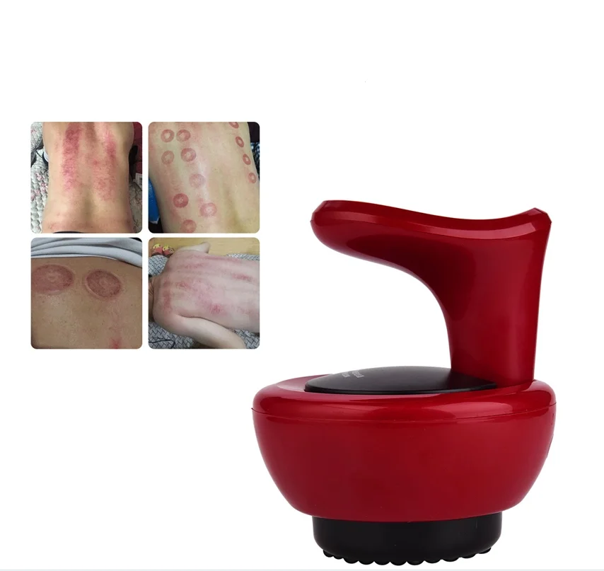 Youmay Rechargeable Vacuum Therapy Machine Cupping Therapy Set Pain Relief Device Relax Deep Tissue Cellulite Therapy Massager
