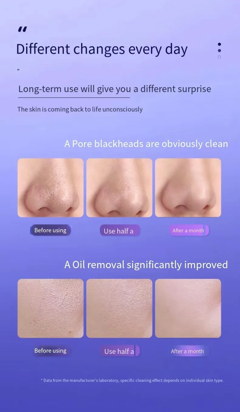 Facial Deep Cleaning Device Portable Ultrasonic Skin Scrubber Spatula Blackhead Remover Pore Cleaner Face Scraper Comedone