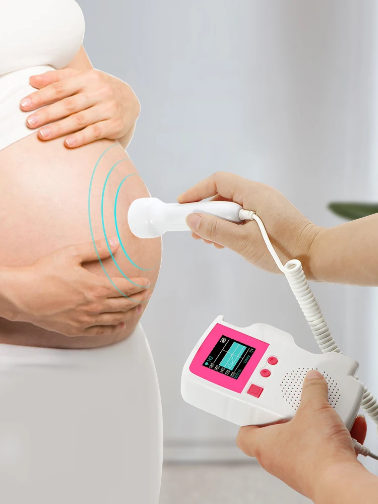 Электрический пренатальный аппарат для измерения частоты сердцебиения плода 3 0 МГц