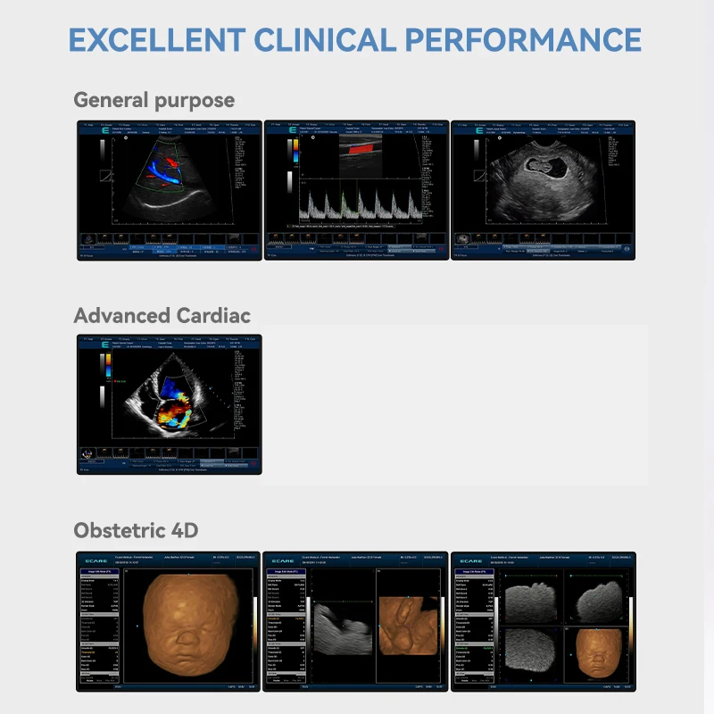 WH-29 Hot Sales color doppler ultrasound machine veterinary ultrasound machine price for laptop computer