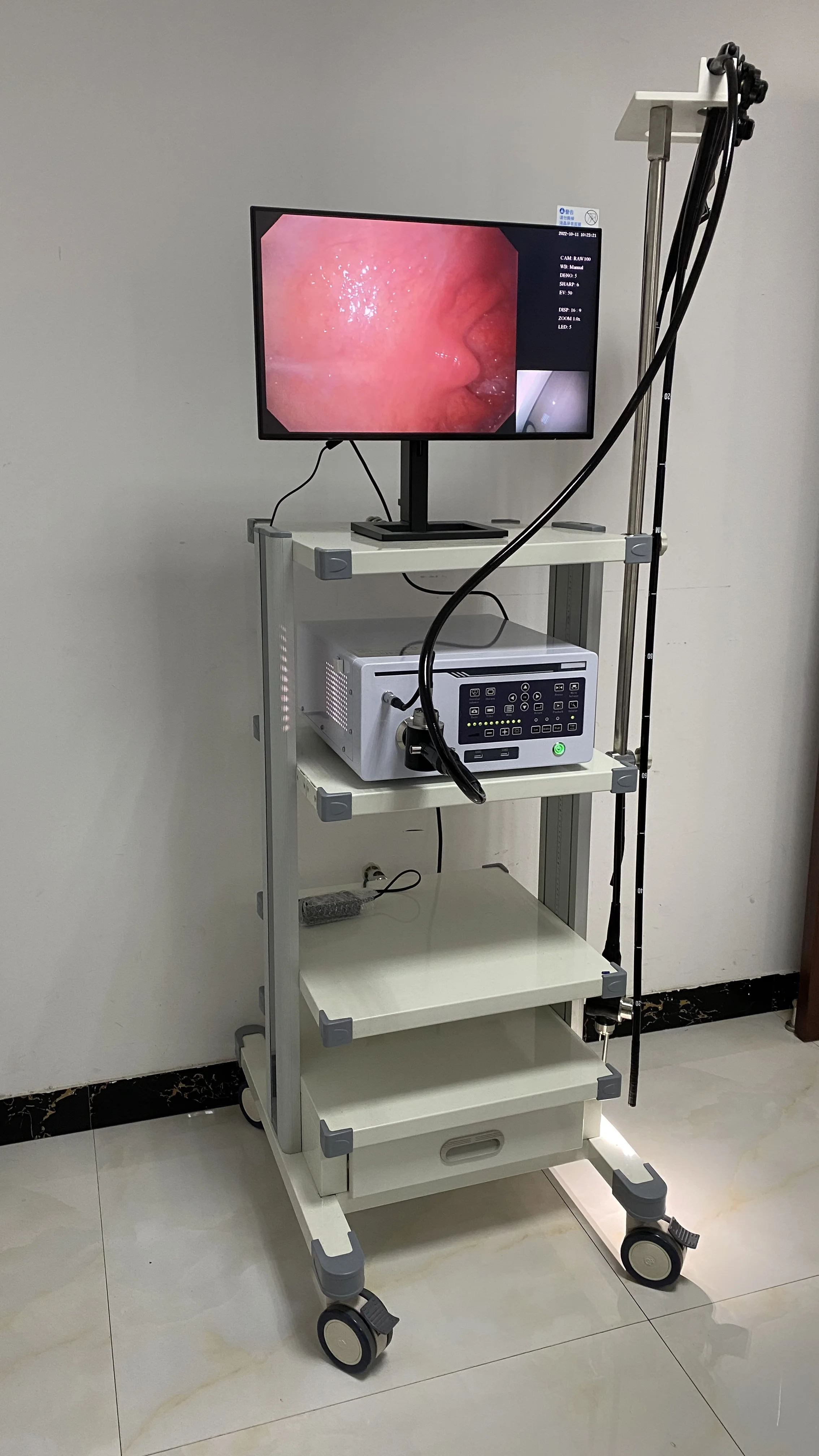 Digital Endoscope System Machine Gastroscope and Colonoscopy with Anesthesia for Trolley Camera