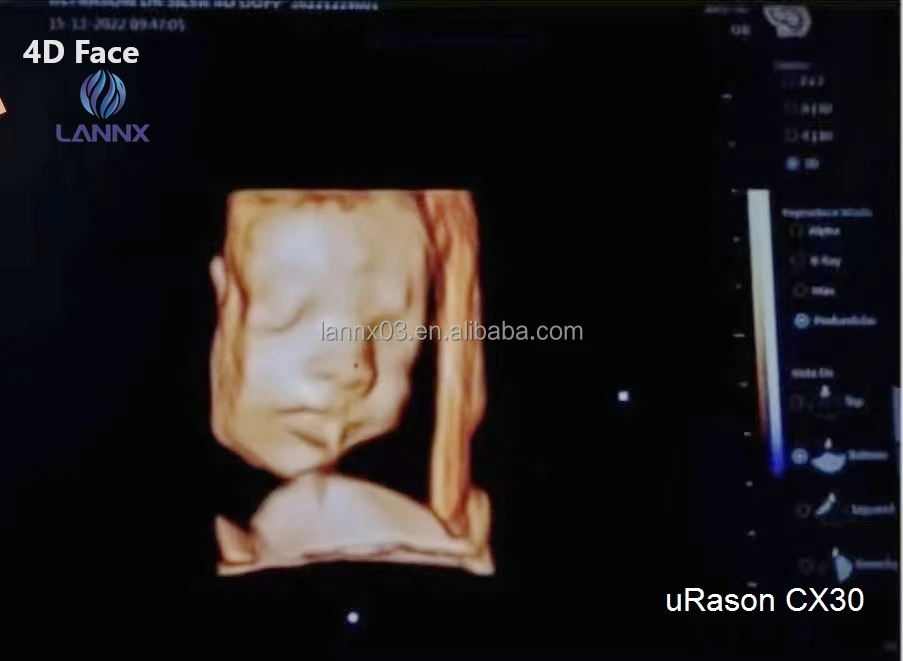 LANNX uRason CX30 New Arrival 3d/4d color doppler ultrasound ultrasonic Scanner Diagnostic System portable ultrasound machine