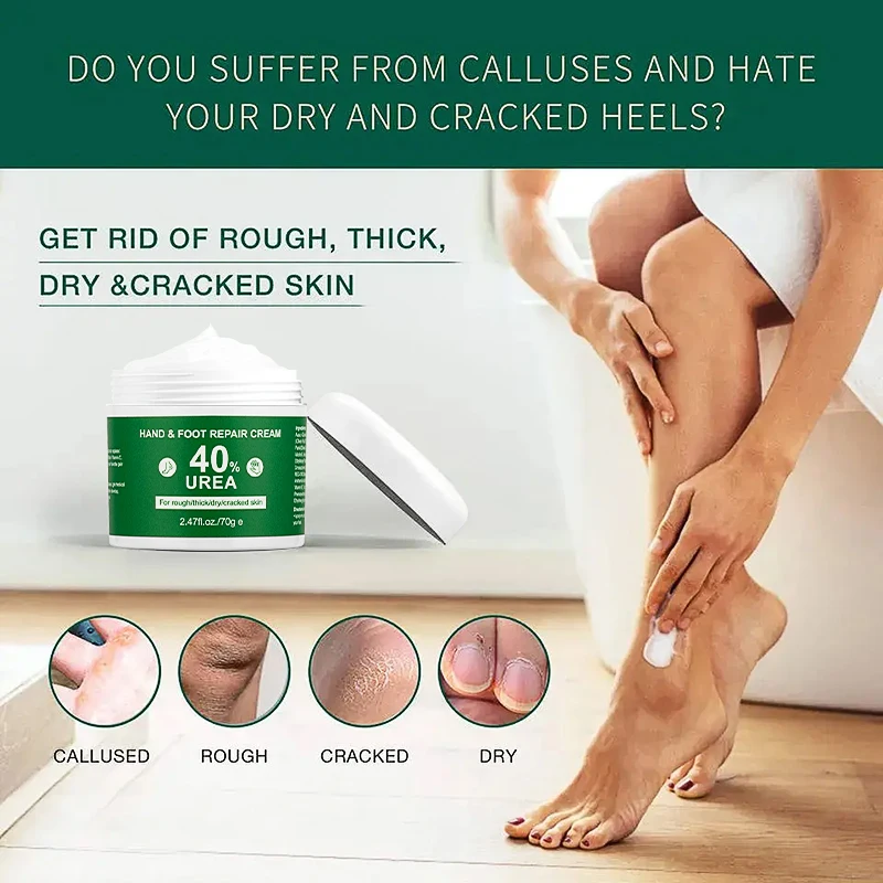 Высококачественные средства для ухода за ногами лучшее отбеливание пятки удаления омертвевшей кожи ремонт ног масло ши мочевина крем рук и