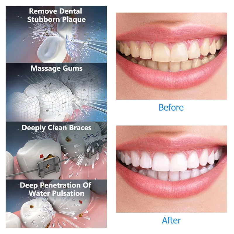 Cordless Water Flosser with 3 nozzles Portable Oral Irrigator Dental Flosser With Teeth Cleaning