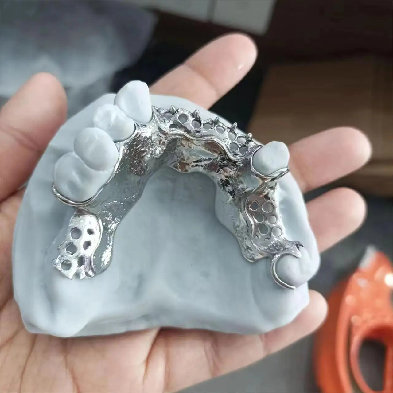 3D printing Cobalt chromium titanium metal stent frame printing dental design