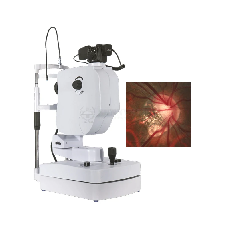 SY-V036-1 Eye Fundus Camera FFA / Retina Camera Non-Mydriatic Retinal Fundus Photography For Ophthalmology