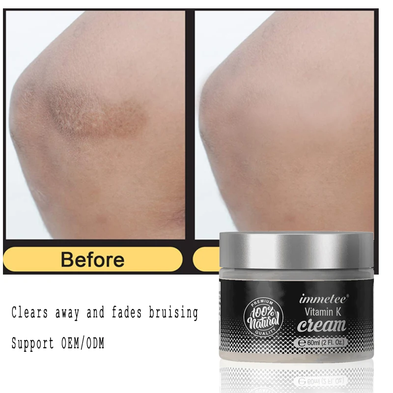 OEM/ODM Moisturizer Face Cream Organic Vitamin Anti Wrickle Nourishing Skin Care Vitamin K Cream