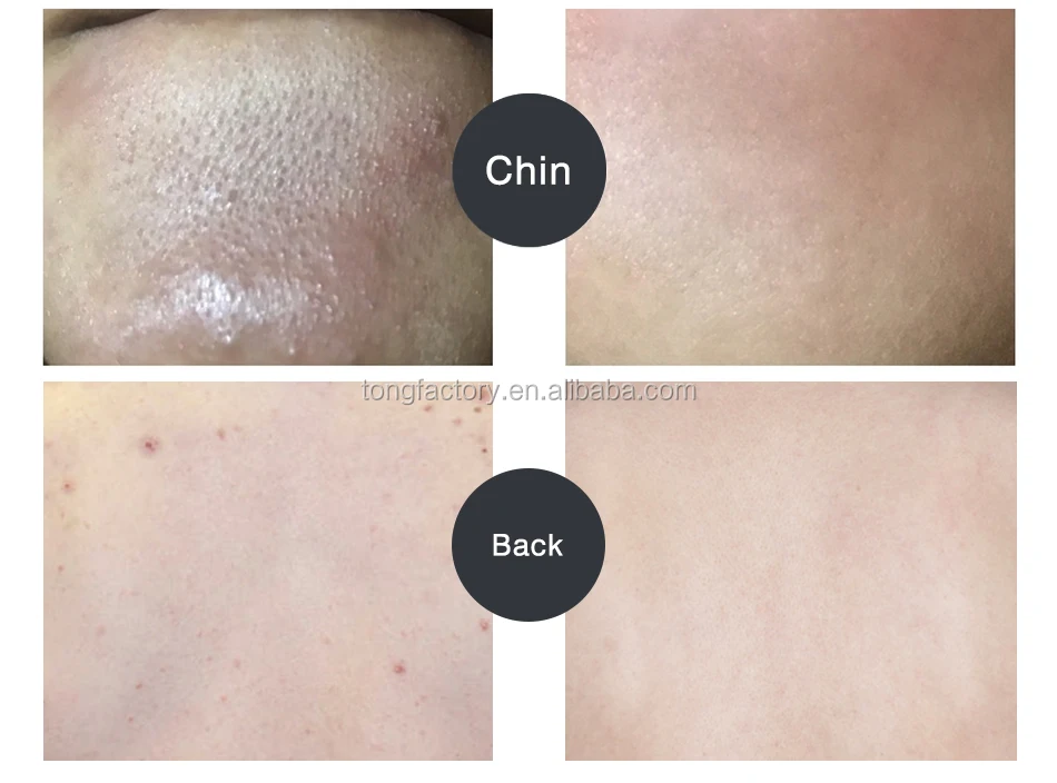 omy lady organic bamboo charcoal facial mask mud mask face peel cream for face whitening