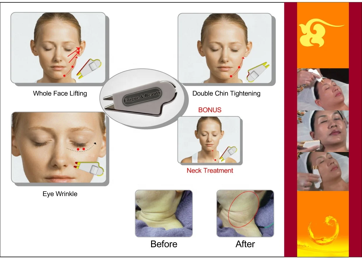 2024 New EMS Microcurrent Eyes Care Dark Circles Remove Machine Eye Massager Anti-wrinkle for Removing Dark Circle  Machine
