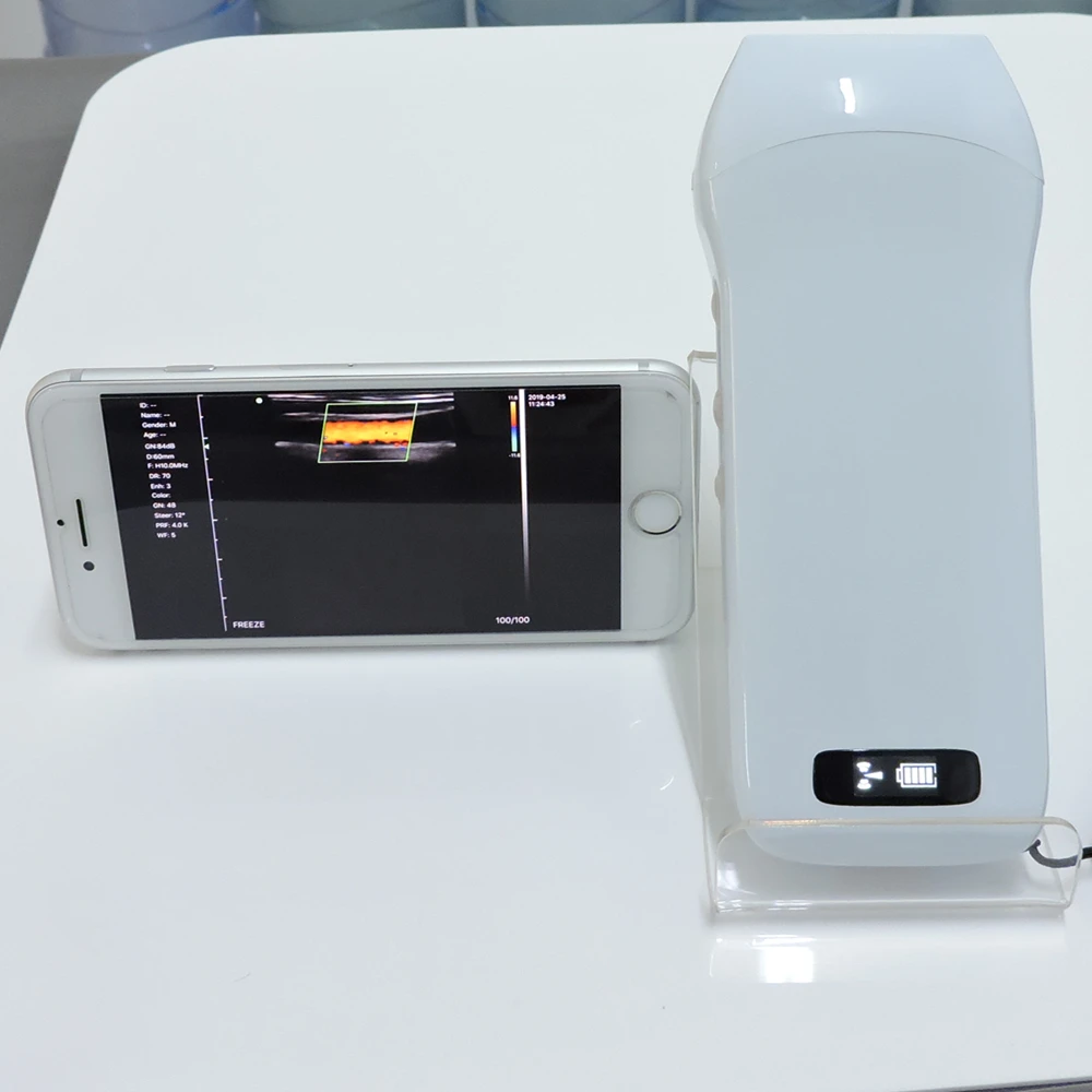 Ультразвуковая сканирующая машина, ультразвуковой датчик, Цветной Допплер, беспроводной ультразвуковой зонд C10CX C10CT