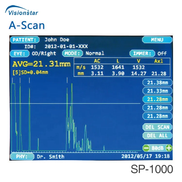 Top Quality SP-1000P Ophthalmic Ultrasonic Pachymeter