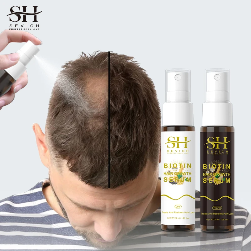 Hair Growth Lotion Customized Hair Growth Oil Manufacturer Biotin Collagen Hair Treatment Spray