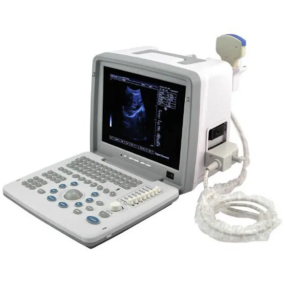KBW-300 Laptop B&W Ultrasonic diagnostic portable B ultrasound scanner