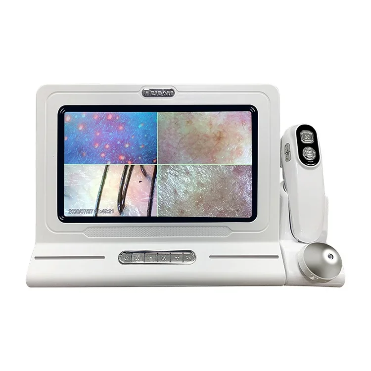 Scalp Detector Hair Test Analyzer Microscopic Skin Scalp And Hair Camera Scalp Microscope Camera
