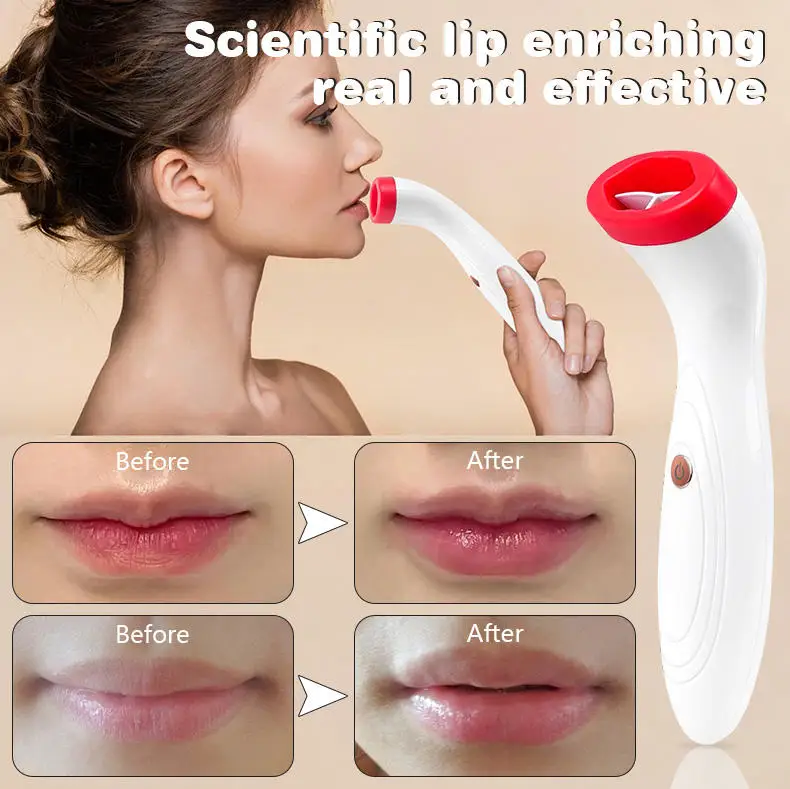 USB Rechargeable Automatic Lip Plumper Instrument Electric Lip Enhancer Plumping Device