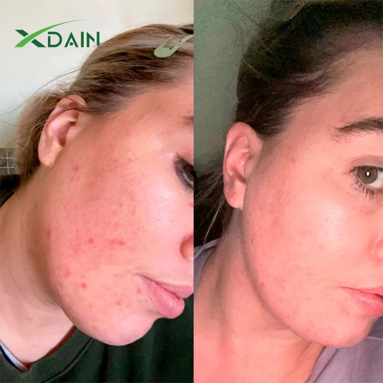 Moisturizing Hyaluronic Acid essence stock solution skin care moisturizing brightening Vitamin c Hyaluronic Acid Serum