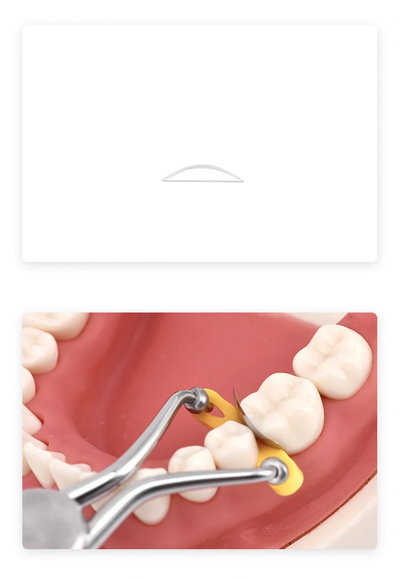 TOPBM Dental Consumables stainless steel dental Matrix Bands