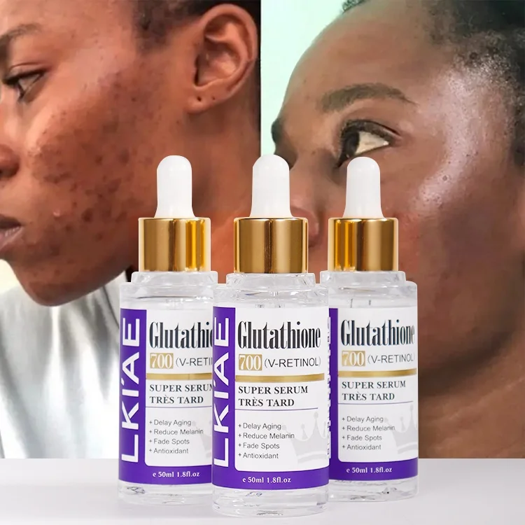 Глутатион 700 витамин е ретинол 50 мл корректор меланина тускнеет уход за кожей отбеливающая Сыворотка для лица