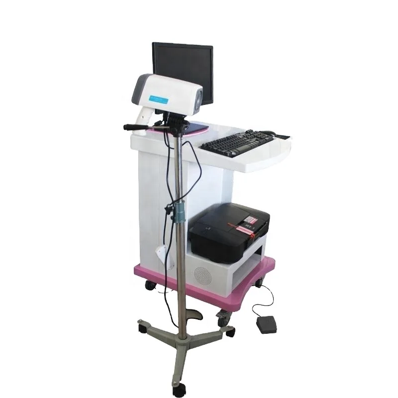 Hot selling mini digital colposcope for gynecology