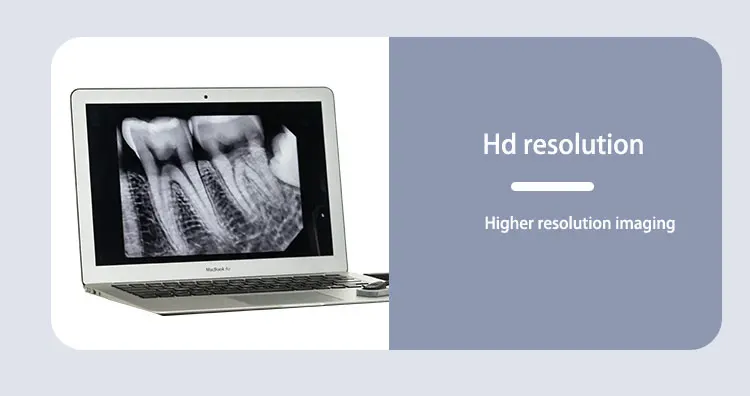 Tube Runyes Portable Dental X Ray Machine Unit With Digital  Xray Sensor Imaging System