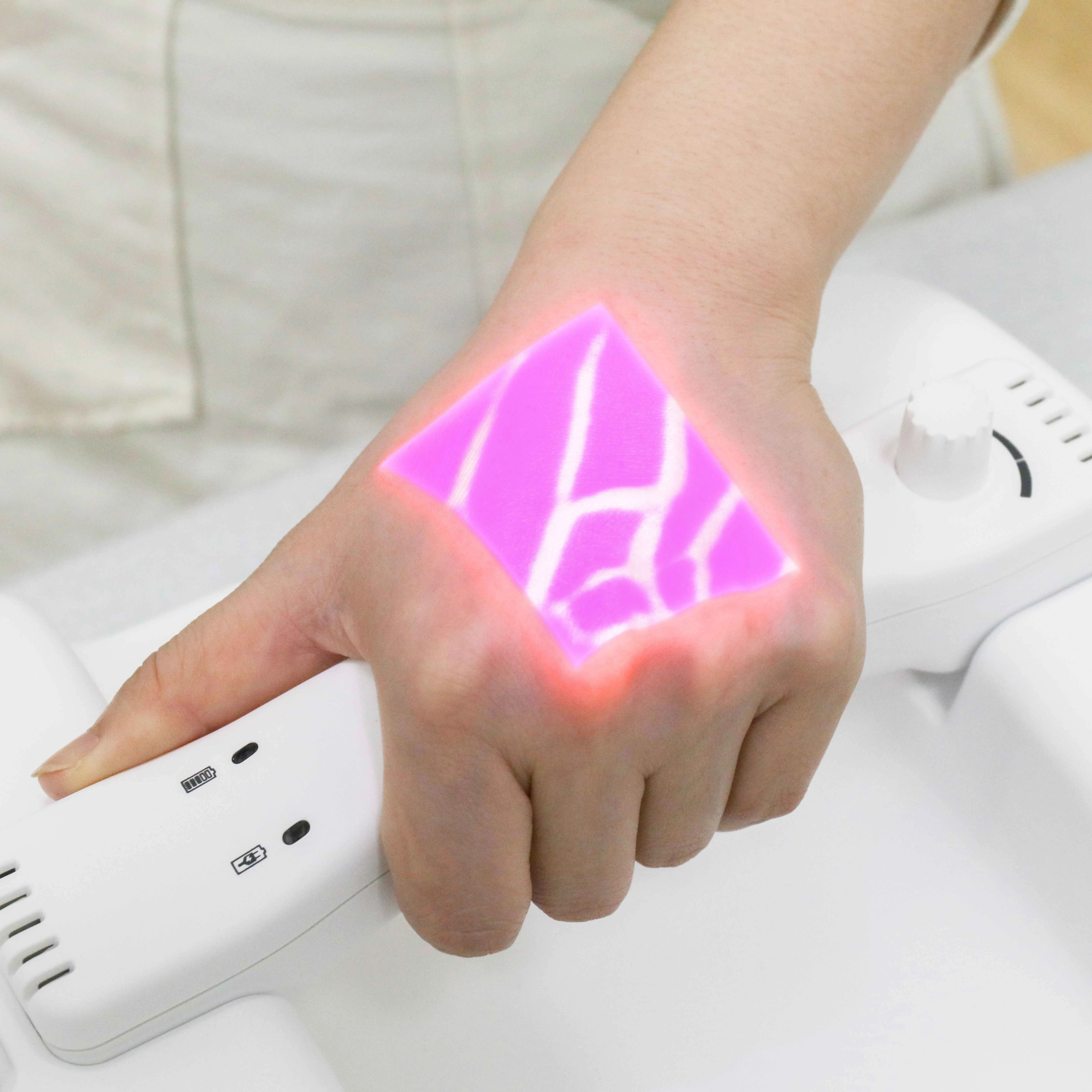 Hospital Visual Vein Finder Vein Locator for sale