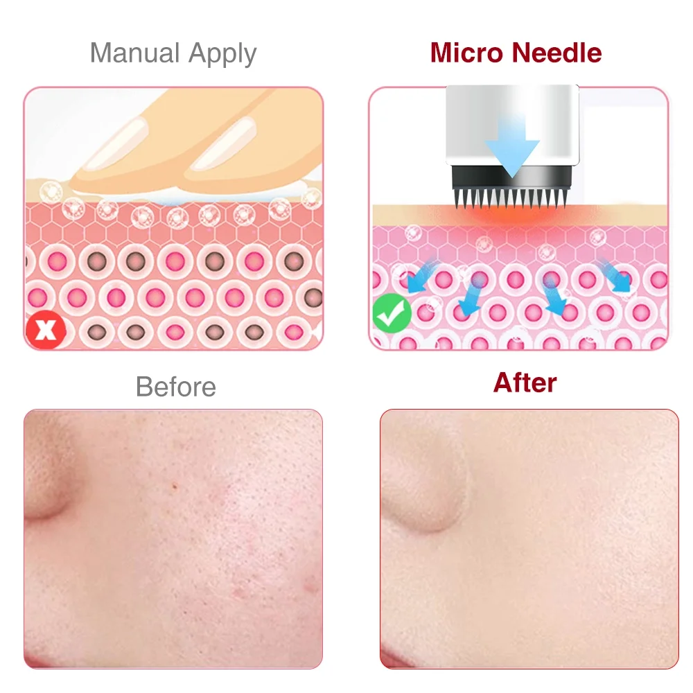 Home Use Micro Needle Microneedling Derma Pen Skin Care Needle Cartridge For Acne Treatment