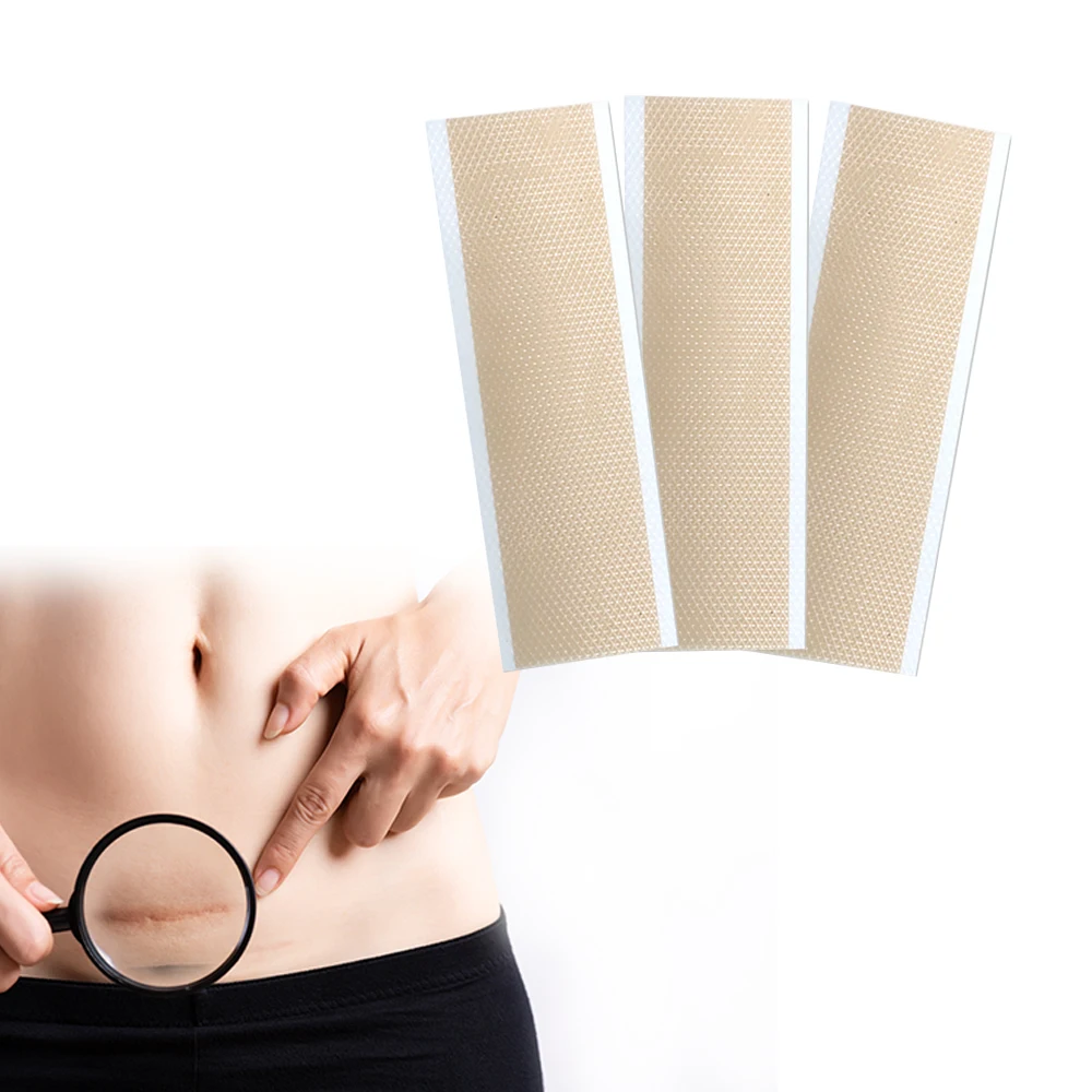 Scar sheets reusable scar tape for c-section keloid bump stretch marks burn tummy tuck surgical scar removal