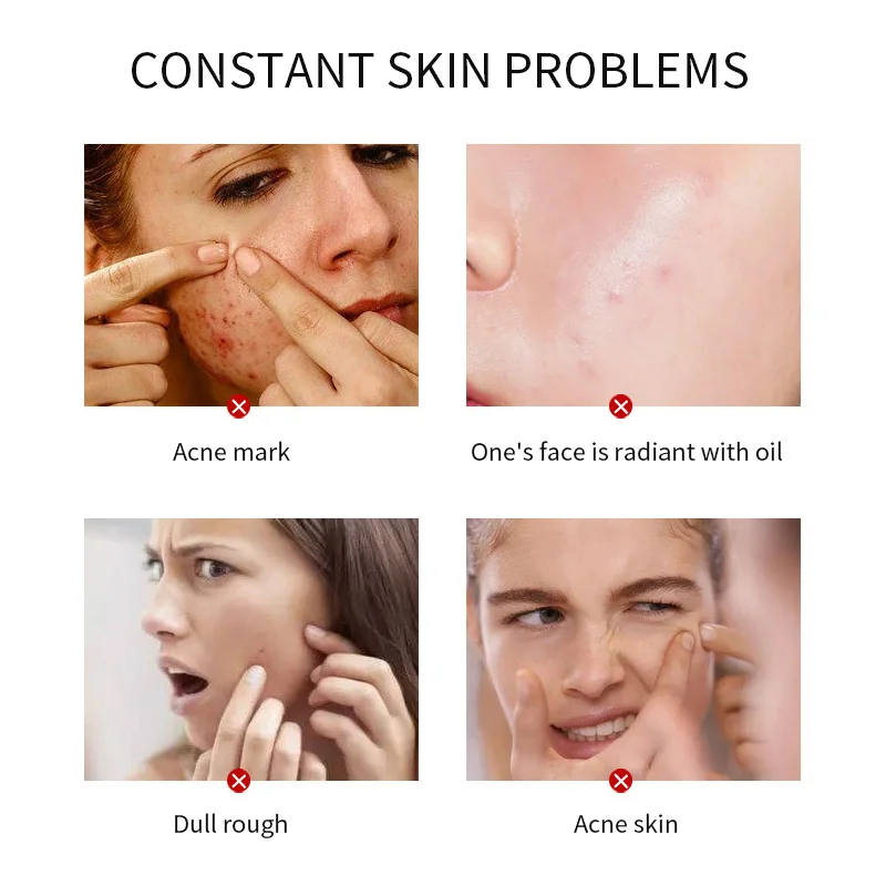 Private Label Natural Facial Anti Acne SkinCare Set Repairing Barrier Brightening Moisturizing Repair Women Skin Care Set