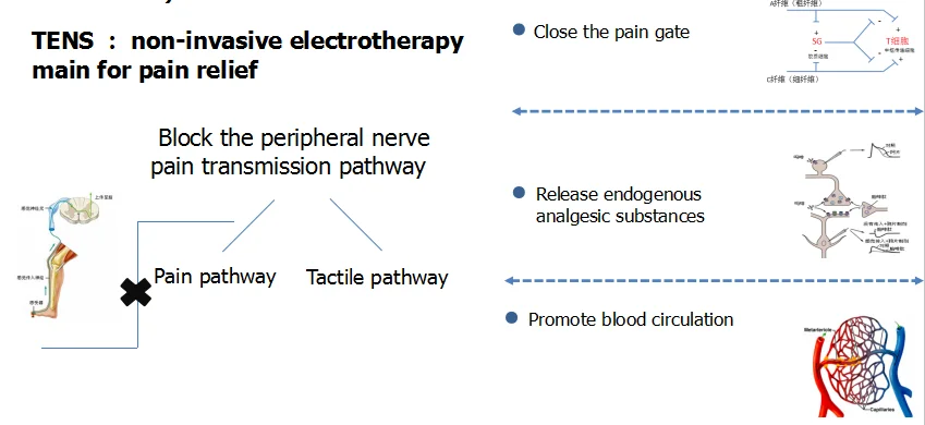 Hot Sell  Wireless Electro-therapy Device Eletromagnetic Muscle Stimulator TENS NMES
