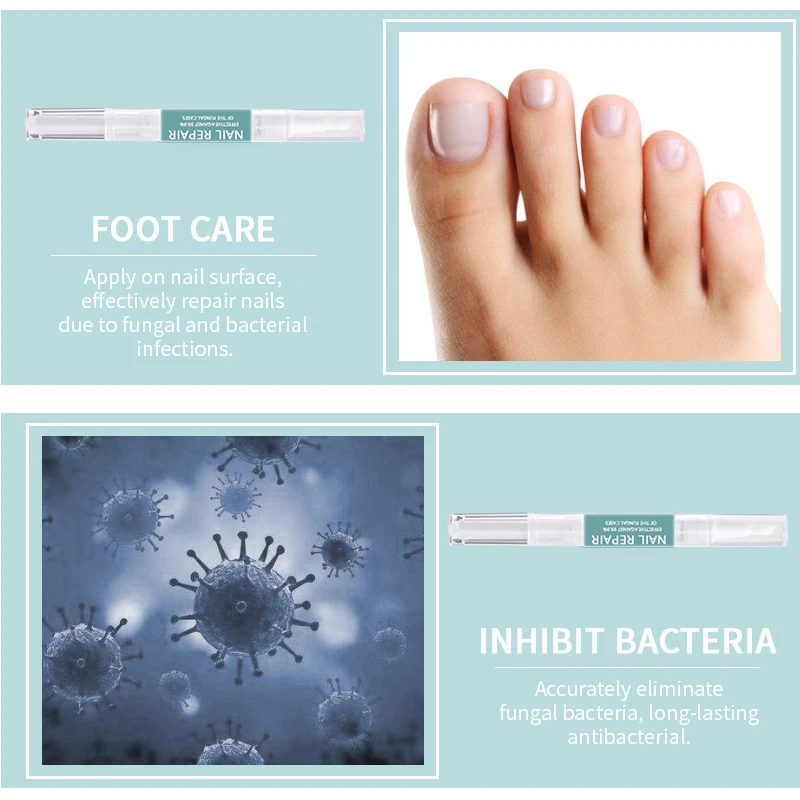Private Label Anti Fungal Nail Fungus Treatment Repair Pens for Toenail Fungus Infection and Fingernail
