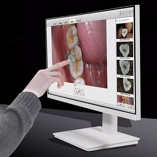 china usb 24 Inch Touch Screen Dental  all in one intraoral camera with monitor