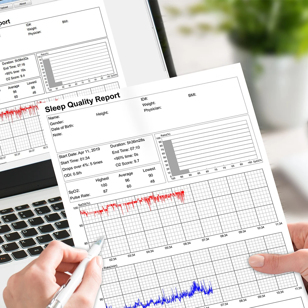 Умное кольцо Wellue O2ring, мониторинг сна, пульсометр, оксиметры, пульсовое апноэ