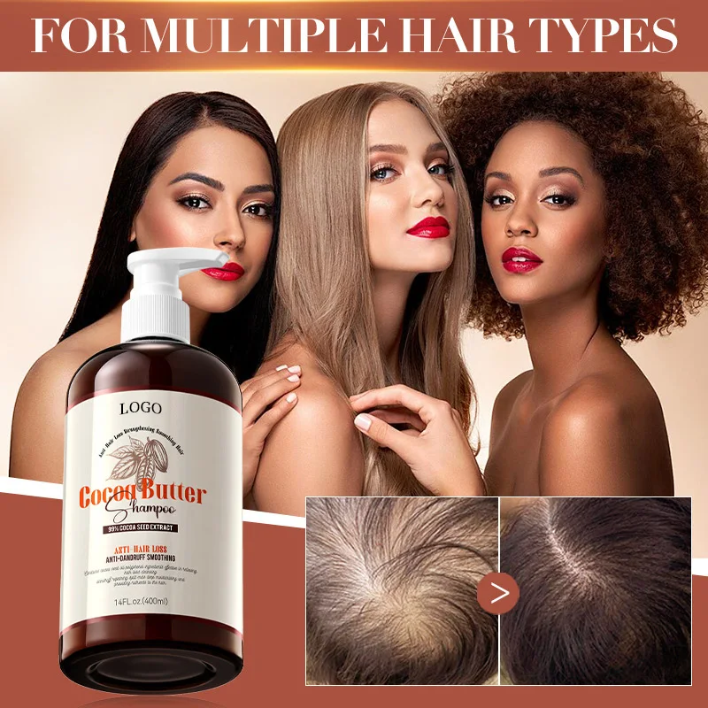 Reduce Hair Loss Product Private Label Guangzhou Factory Manufacturer Wholesale Organic Herbal Hair Care Anti Hair Loss Shampoo