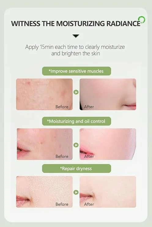 Private Label 99% Aloe Vera Gel Brightening Skin Anti Acne Repairing Sun Damage Firming Rejuvenating Skin Aloe Vera Gel