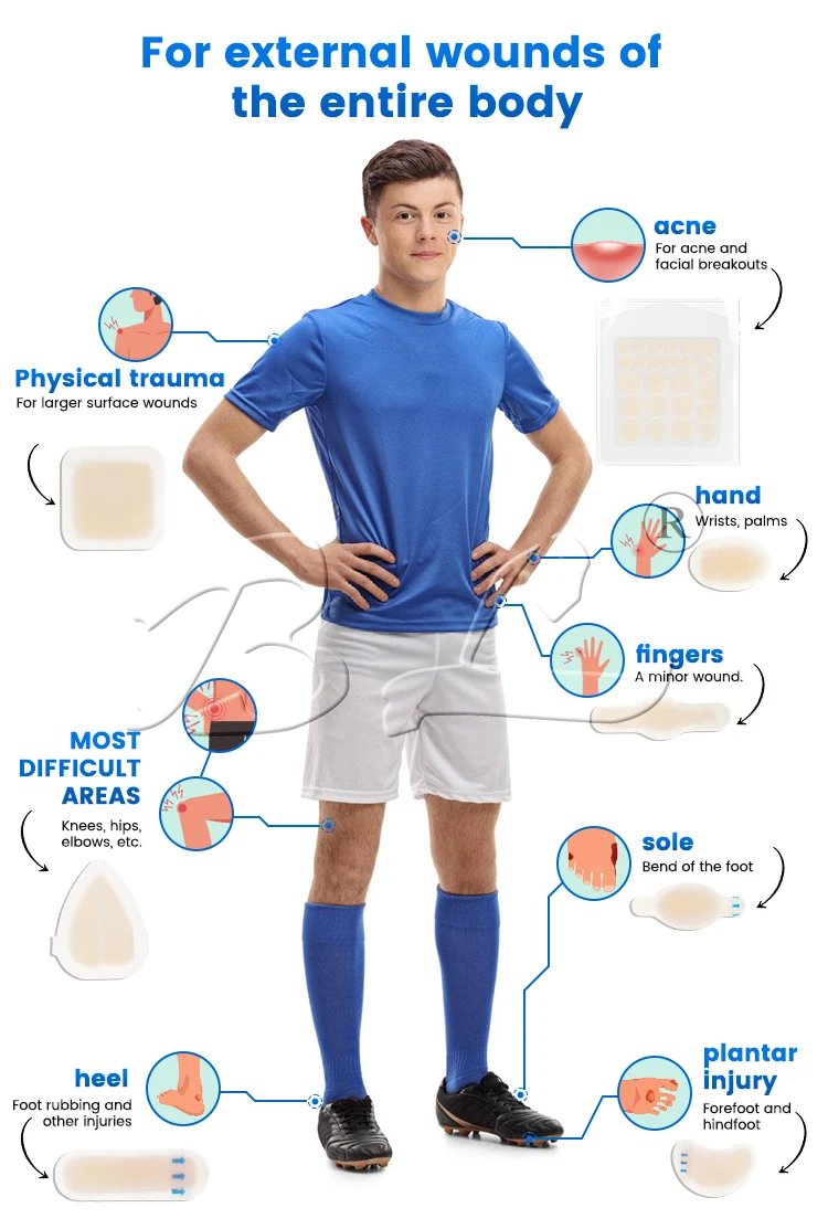 Hydrocolloid Wound Dressing Product Education Water Resistant Wound Care Hydro-colloid plasters