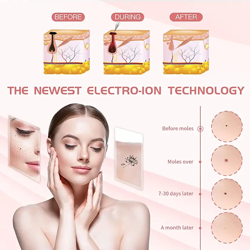 Laser Plasma Pen Led Skin Tag Tattoo Removal Portable Wart Dot Dark Spot Mole Spot Removal Plasma Pen