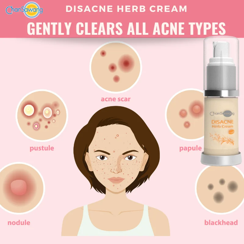 Anti Acne Cream and VitaminA for Acne Treatment Scar Removal & Blemish Removal of Premium Product Skincare from Thailand